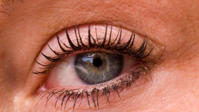Как да върнем белотата на очите си?