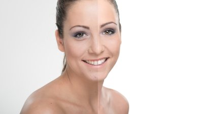 Причини за поява на пигментация и решенията срещу нея