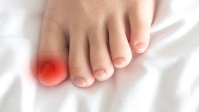 Как да се справите с врасналите нокти на краката?