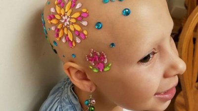 Когато болестта не може да надвие детската усмивка (галерия)