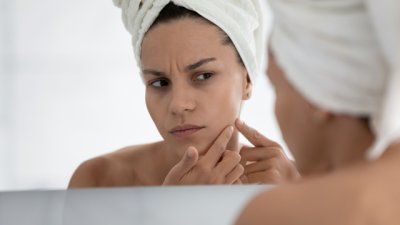 Най-добрите етерични масла при акне