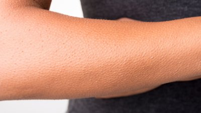 Какви странни неща правят телата ни от студ?