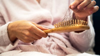 10 възможни причини за косопад 