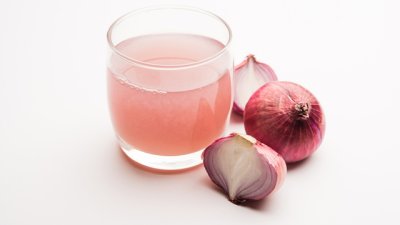 Маски с лук за успокояване на раздразнен скалп и при пърхот 