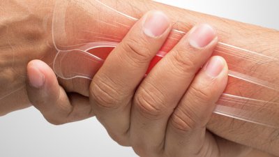 Храни, които помагат за бързо зарастване на счупени кости (галерия)