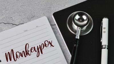 Потвърди се първи случай на маймунска шарка у нас