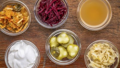 5 храни за насърчаването на добрите бактерии в червата 