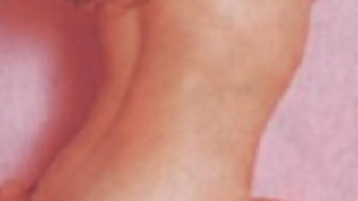 Ерогенните зони