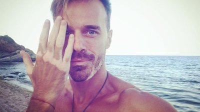 Ники Илиев за витилигото: Добавя цвят към личността