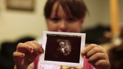 3D ултразвук позволява на родителите да видят бъдещото бебе в цветове