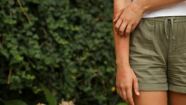 Използвайте оцет. Снимка: istock