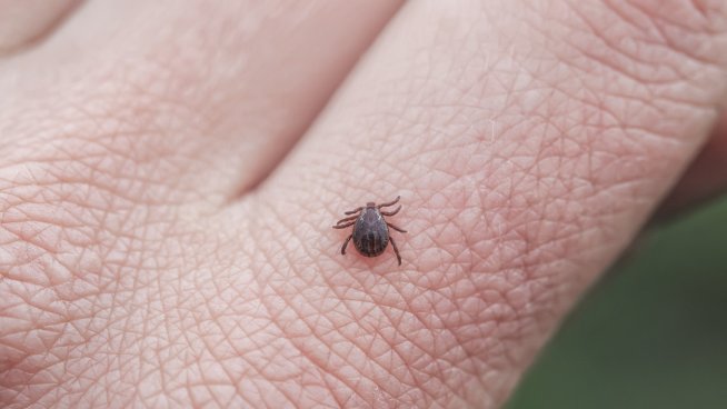 Не бива да се размачква кърлежа, когато се вади. Снимка: istock