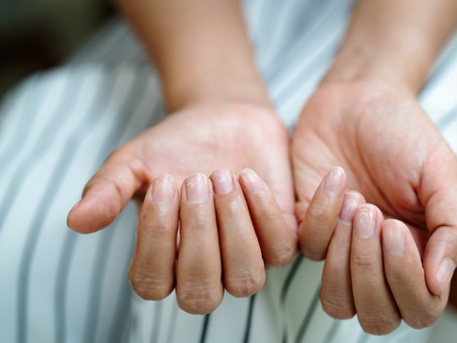 Снимка: istock