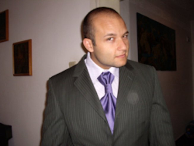 Какво представляват зъбните фасети