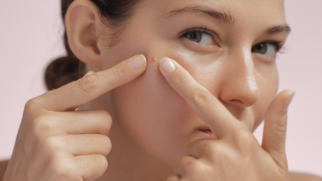 Кои са някои от най-ефективните домашни маски против акне? Снимка: istock