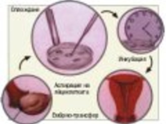 In Vitro или Бебе в епруветка