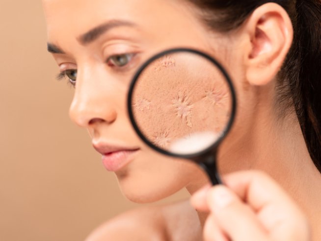 Снимка: istock