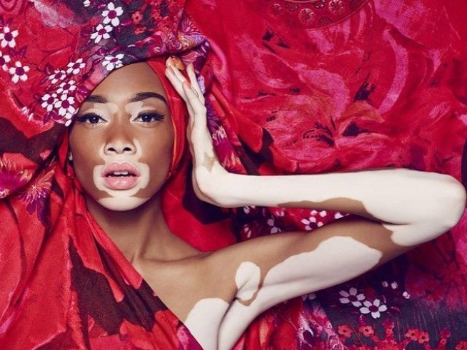Снимкa: facebook Winnie Harlow
