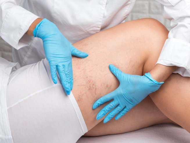 Снимка: istock