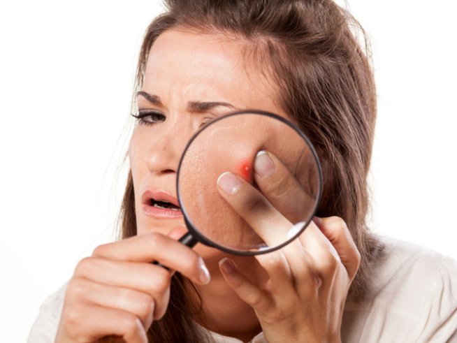 снимка: thinkstock