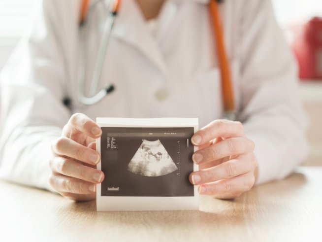 Снимка: thinkstock