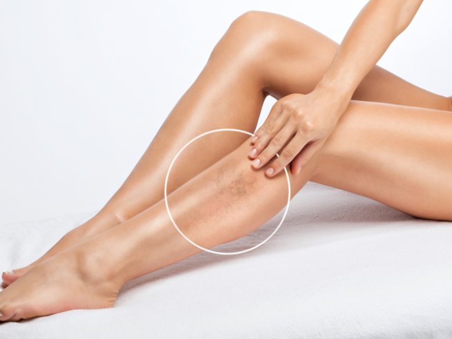 Снимка: istock