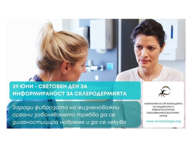 Днес отбелязваме Световния ден за информираност за склеродермията