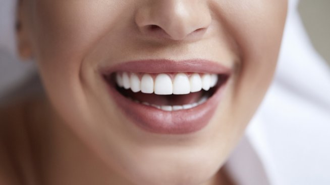 Всеки мечтае за красива усмивка. Снимка: istock
