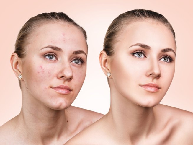 Снимка: istock