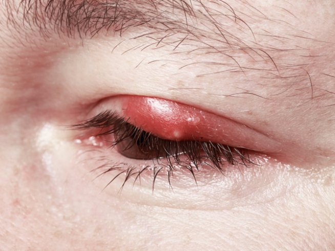 Снимка: thinkstock