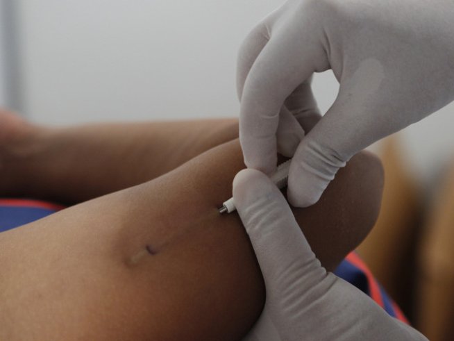 Нивото на прогестерон в ранна бременност показва здравето на ембриона