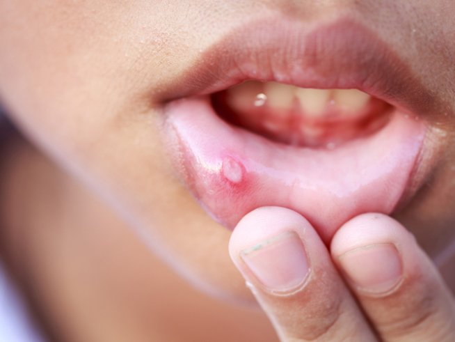 Снимка: Thinkstock