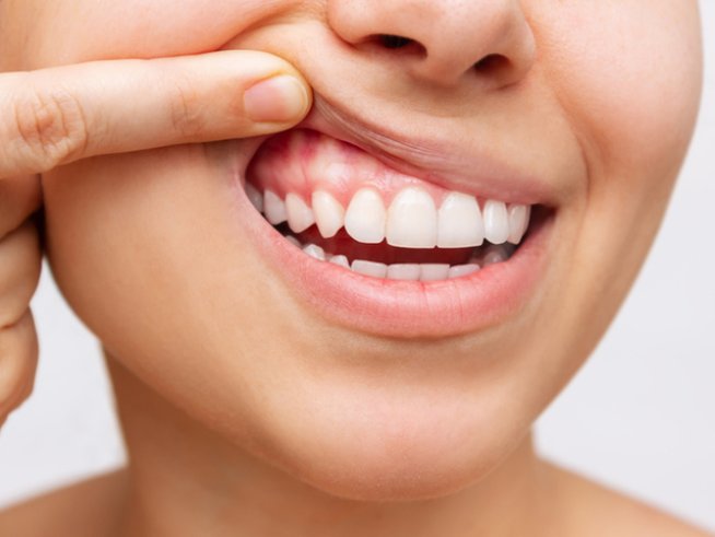 Снимка: istock