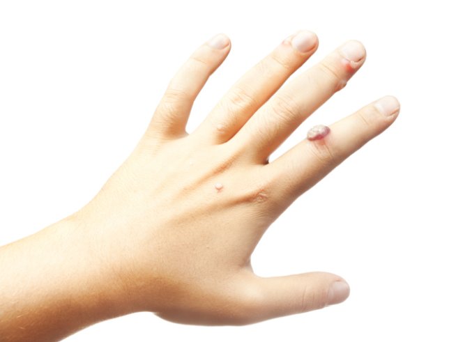 Снимка: Thinkstock