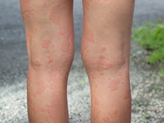 Снимка: istock