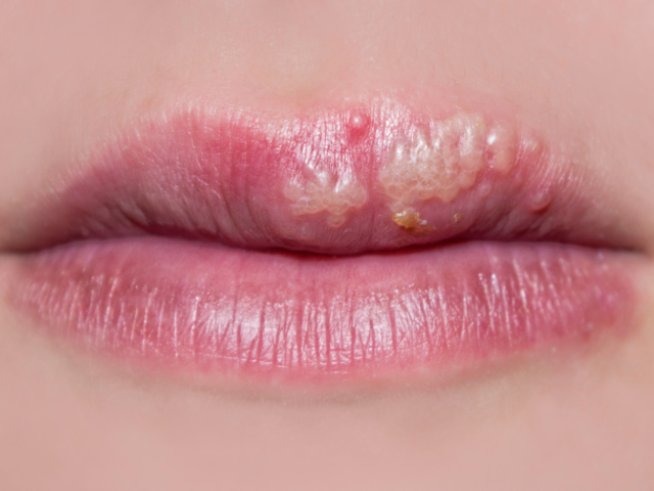 Снимка:thinkstock