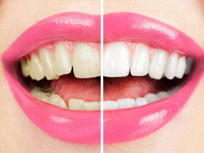 Снимка: thinkstock