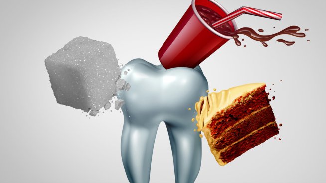 Кои са най-вредните храни за зъбите? Снимка: istock