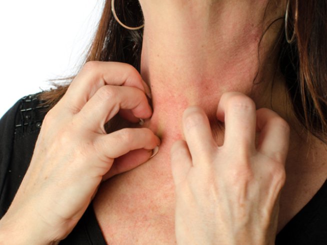 Снимка: istock