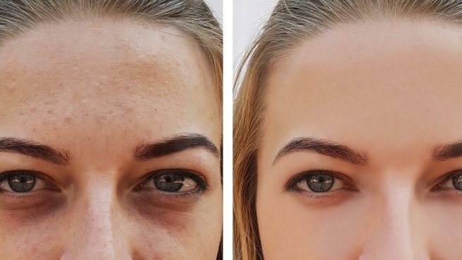 Снимка: iStock