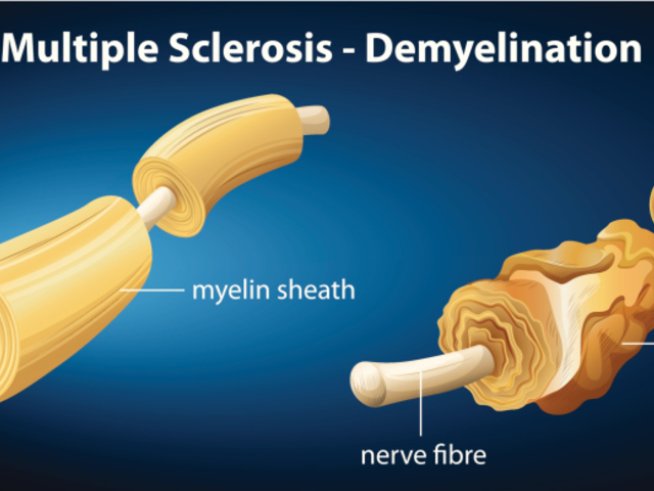 Снимка: Thinkstock