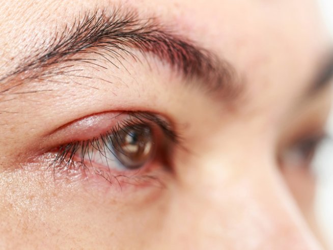 Снимка: istock