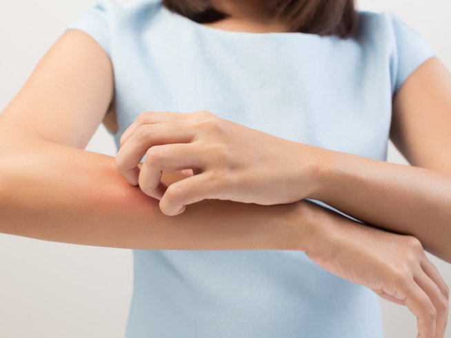 Снимка: istock