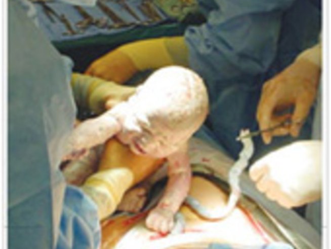 Как предпочитате да родите?