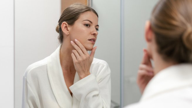 Изненадващи неща, които акнето разкрива за здравето. Снимка: istock