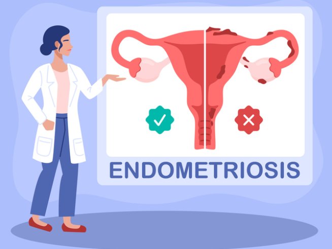 Снимка: istock