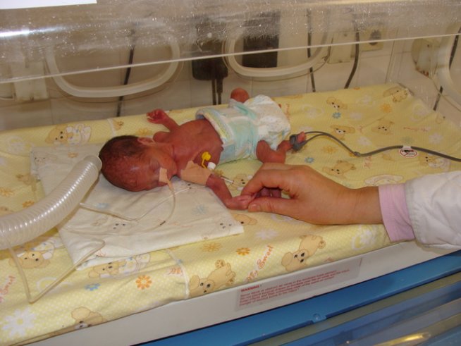 Спасиха 3 недоносени бебета по 800 грама в Бургас