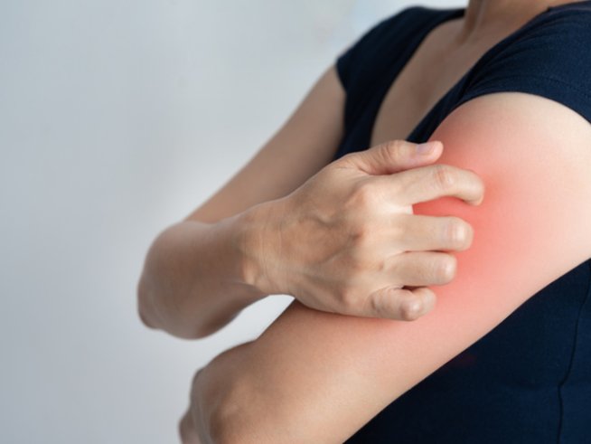 Снимка: istock