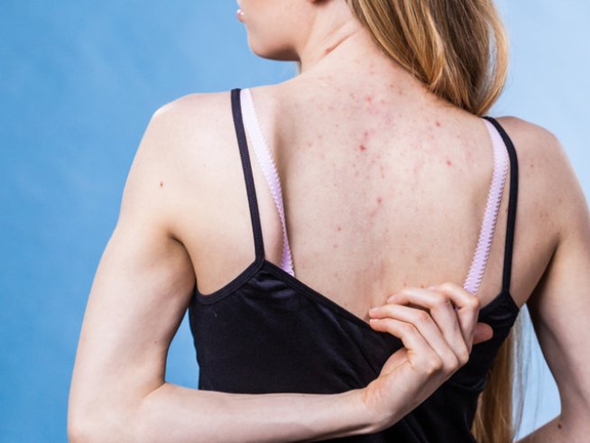 Снимка: istock