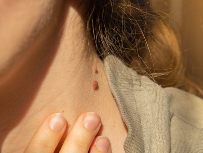 Снимка: istock